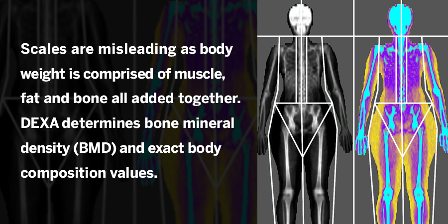 Austin Thyroid now offering DEXA Body Composition