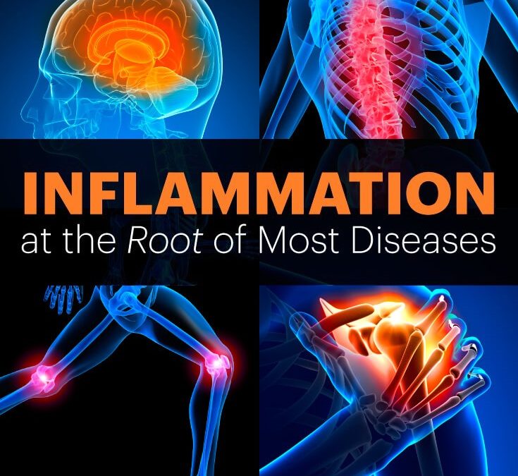 inflammation-7-signs-you-shouldn-t-ignore